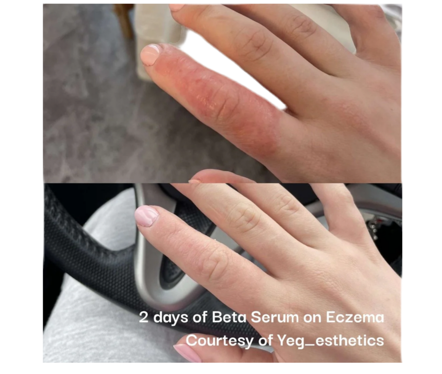 Neogenesis Beta-Glucan Serum