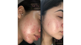 Skin By Mari